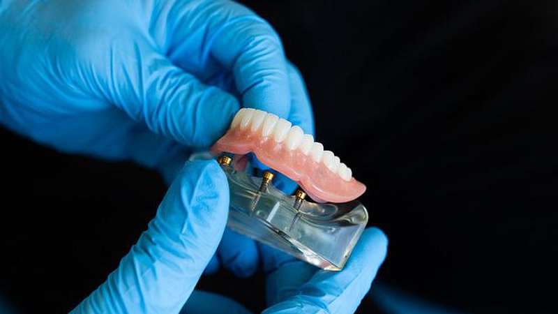  zobna protetika cenik